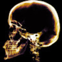 mxookt.png?1761396299